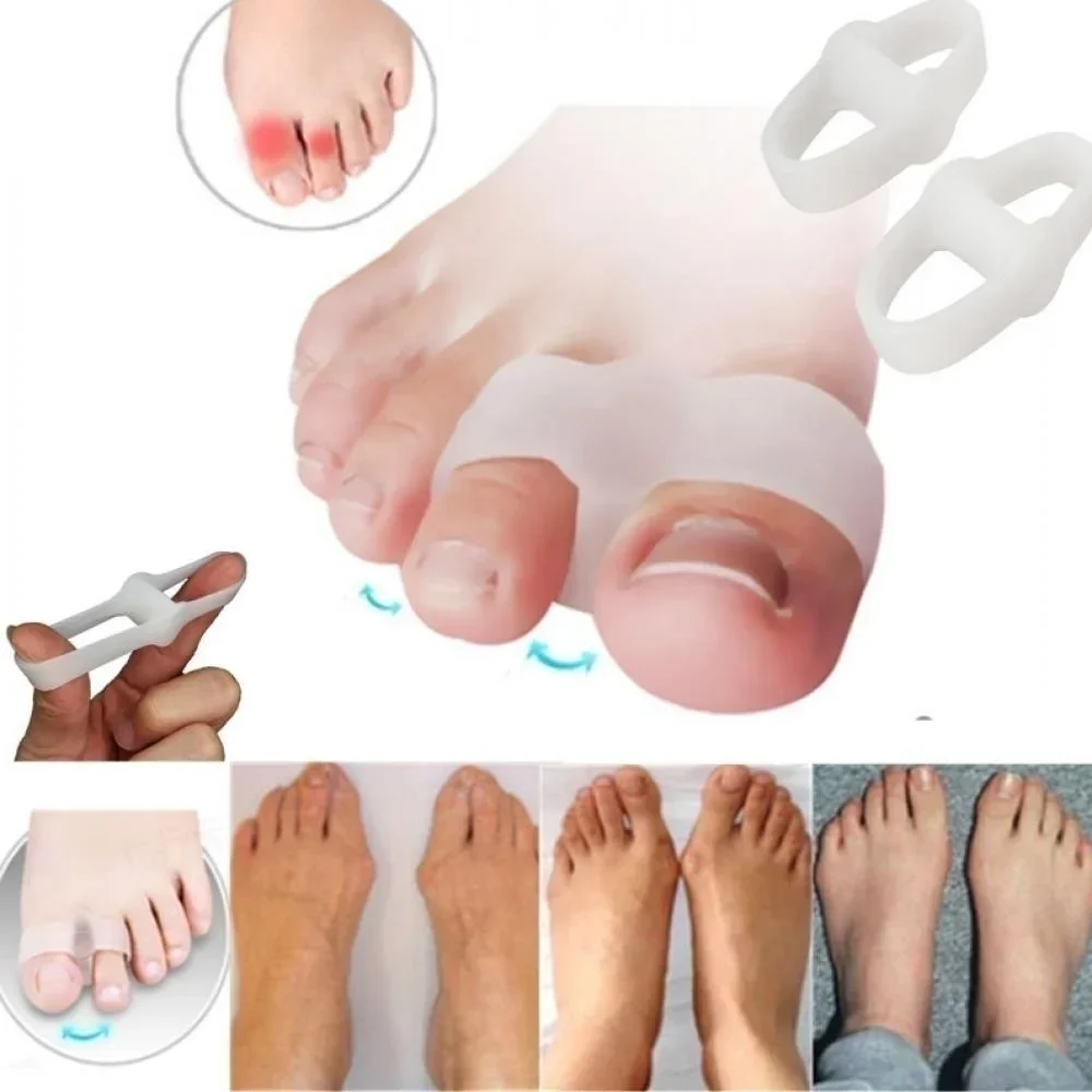 2 Holes Bunion Corrector Pain  - đánh giá và giá Correction Fluid White